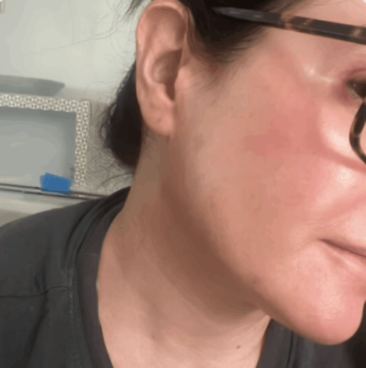 NuraDerma customer review Laura J.